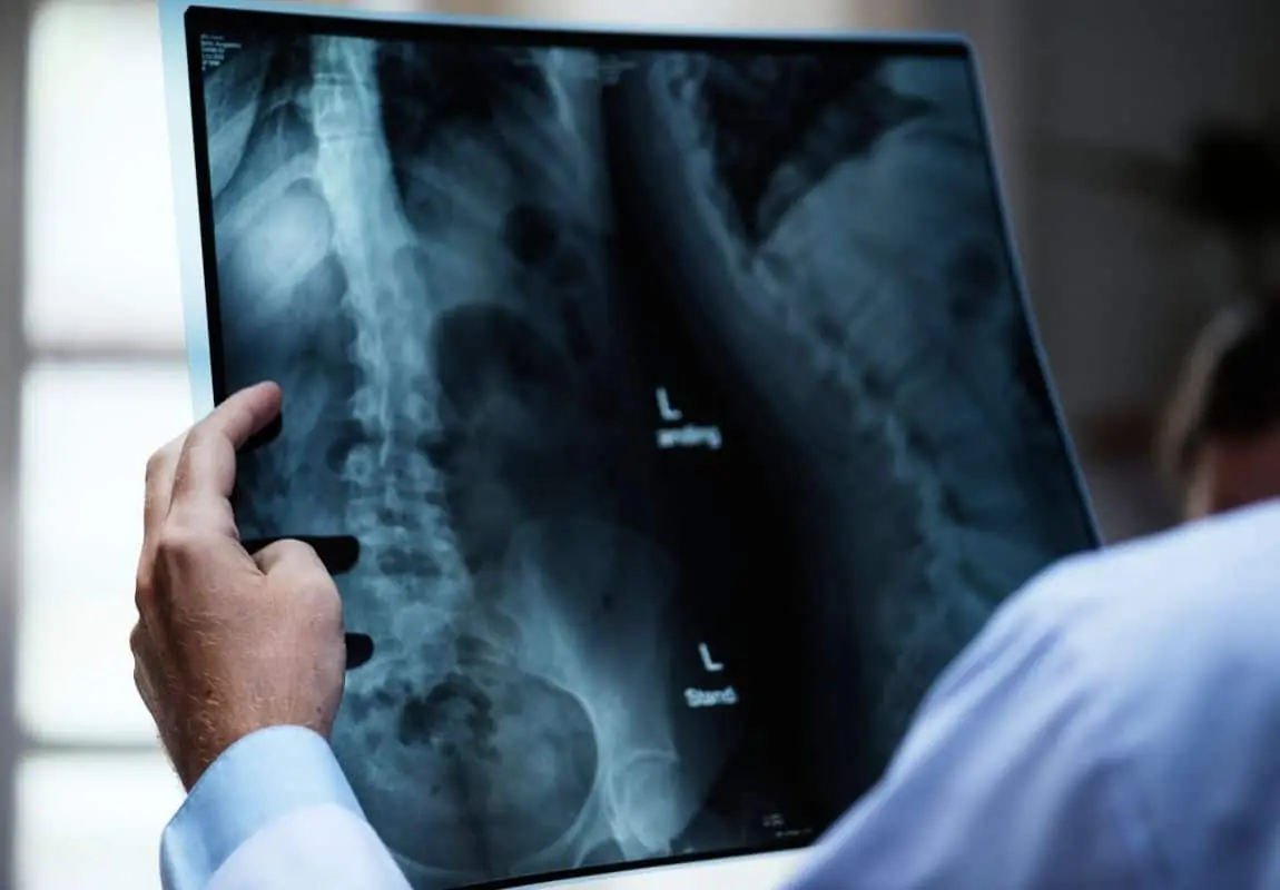 2021-11-Alessandro-Carollo-Trattamenti-Osteopatici-lombalgia