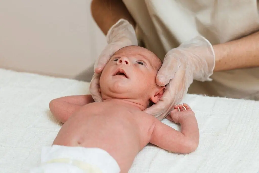 Plagiocefalia posizionale